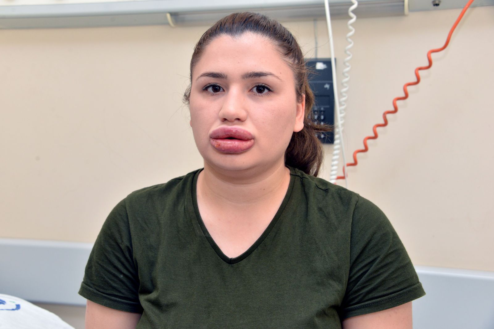 Sahte estetikçiye tahliye