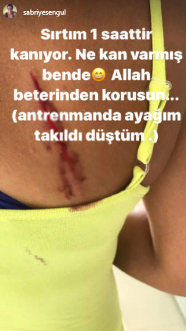 Survivor Sabriye'nin sırtı kanlar içinde kaldı