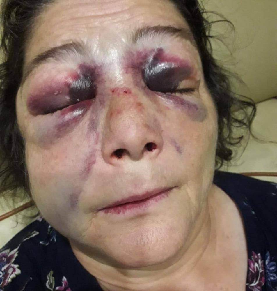 Kadını döverek bu hale getirdiler, CHP'li başkandan şaşırtan savunma