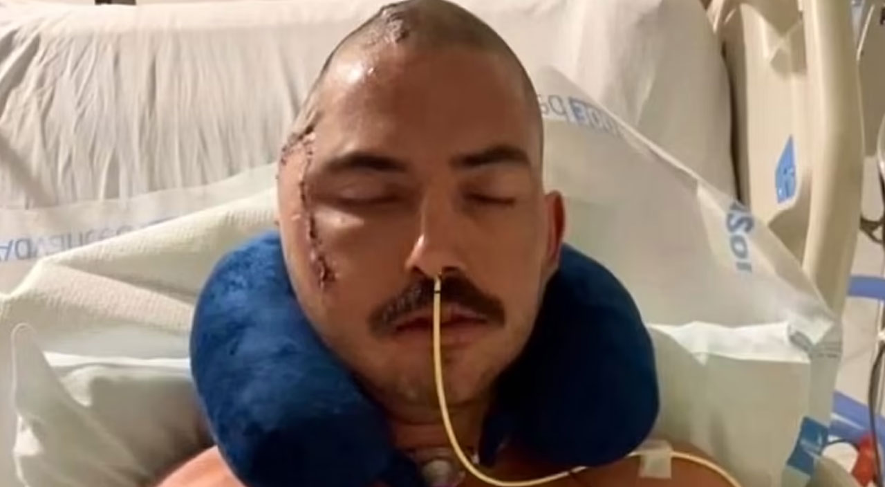 Aç timsaha yem olmaktan kıl payı kurtuldu: Kafatasının yarısını kaybetti