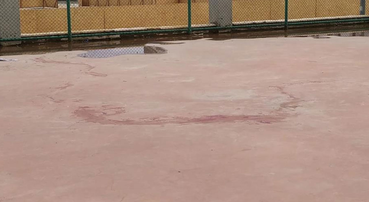 Gaziantep’te pitbulların saldırısına uğrayan küçük kızın hayati tehlikesi sürüyor