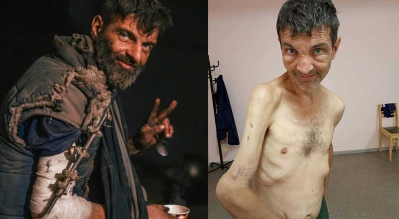 Rusya'ya esir düşen Ukraynalı askerin son hali sosyal medyada gündem oldu! Dehşete düşüren görüntüler