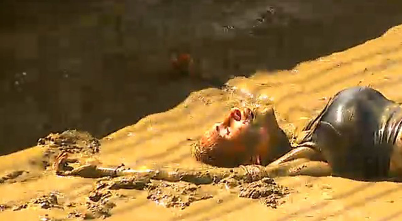 Survivor’da feci kaza: Sema kötü düştü, herkes yardıma koştu! Survivor Sema sakatlandı mı, sağlık durumu nasıl?