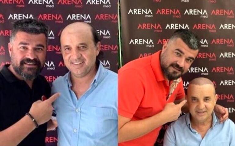 Suat Kaya, 20 yıllık peruğunu çıkardı! İşte yeni hali...