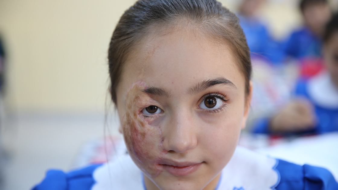 Suriye'deki iç savaşın yetim bıraktığı kız çocukları