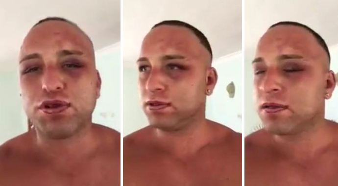 Survivor yarışmacısı Taner Tolga Tarlacı'yı 15 kişi dövdü