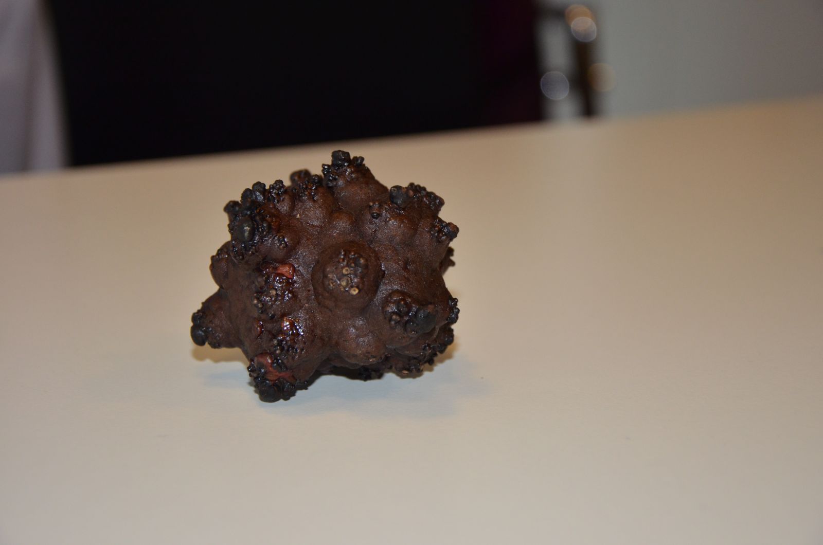 Mesanesinden 220 gram ağırlığında taş çıktı!