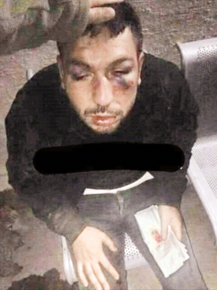 Diyarbakır bombacısı itiraf etti: Ben aracı getirdim Mahsun da patlattı