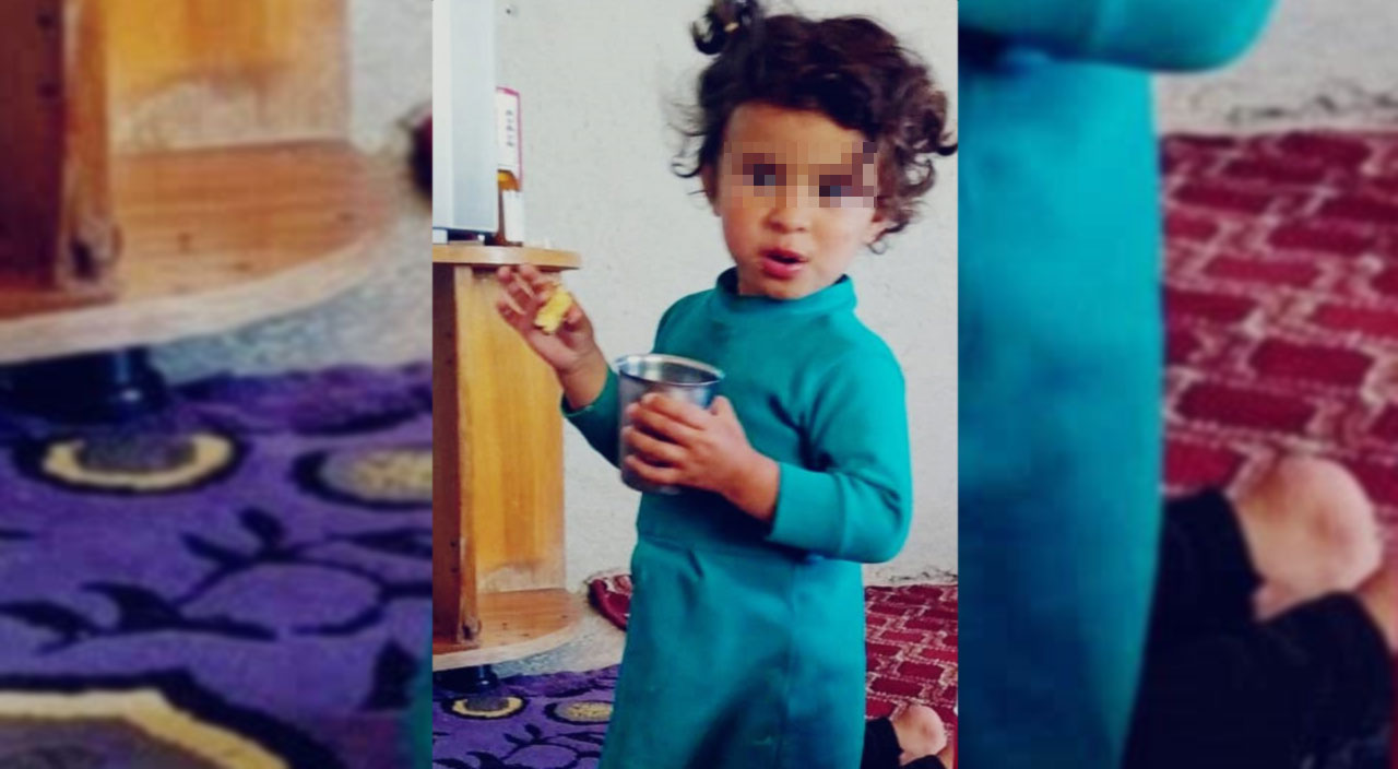 Şanlıurfa'da eşek dehşeti! 3 yaşındaki kızın göz kapağını kopardı