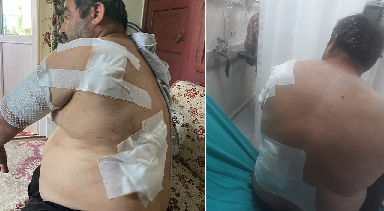 Bartın'da feci ayı saldırısı: Böbreklerimi söktü... Öldü sanınca bıraktı