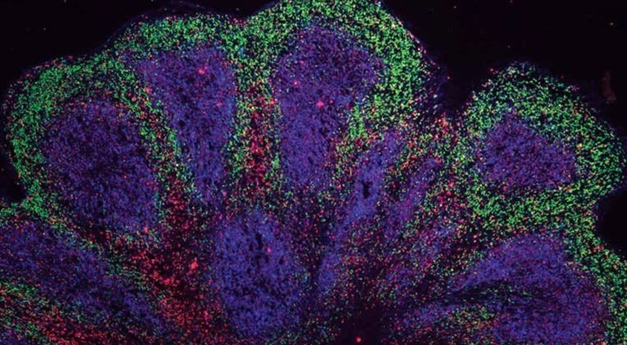 Demans ve felce karşı laboratuvarda mini beyinler üretiliyor
