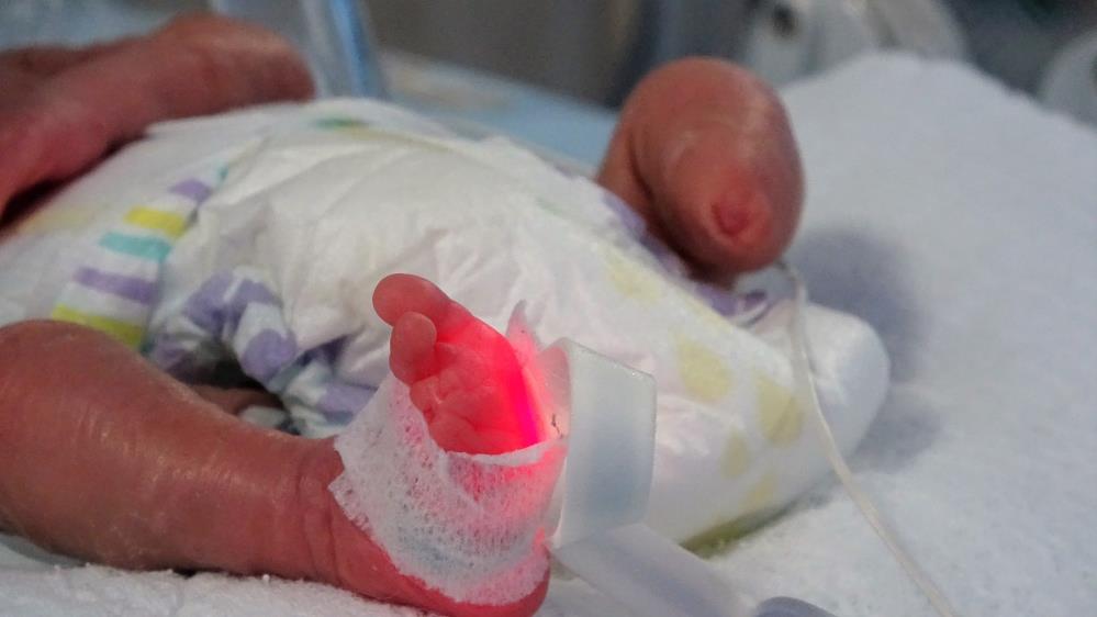 Parmak bebek ayaksız olarak dünyaya geldi