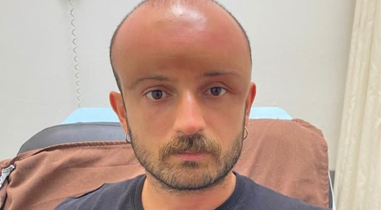 İki gün plaja gitti, hayatının şokunu yaşadı! Literatürde örneği yok! Milyonda bir görülüyor