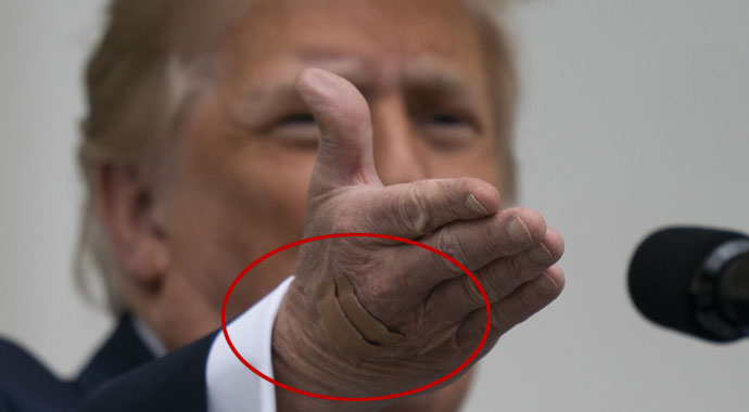 'Trump’ın başkalarına Covid-19 bulaştırma riski artık yok'