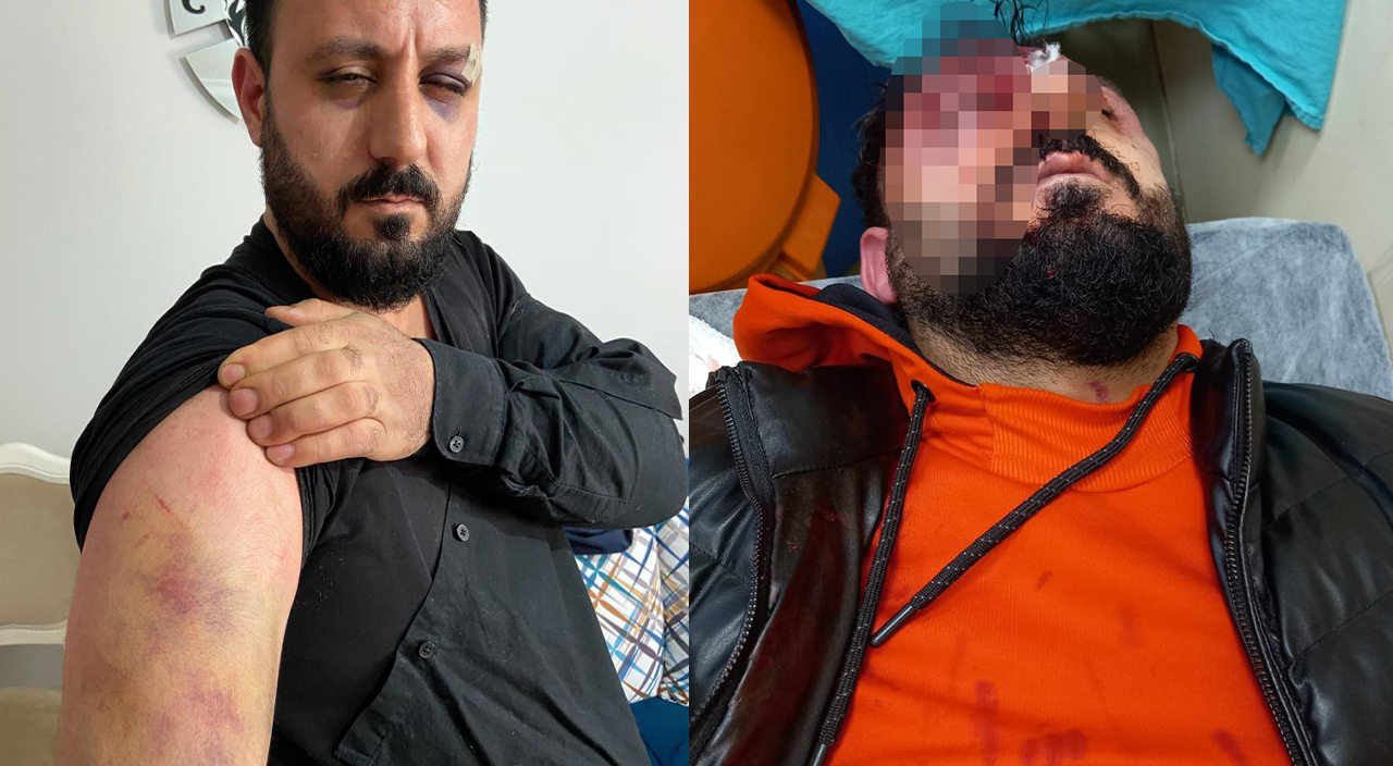 “Kime geldiniz” sorusu canından ediyordu! Öldüresiye dayak yedi