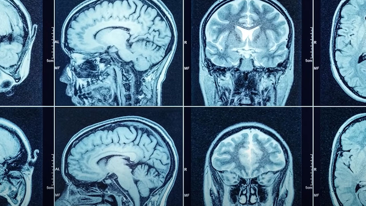 Çarpıcı bulgular: UFO gördüğünü söyleyen pilotların beynini inceledi