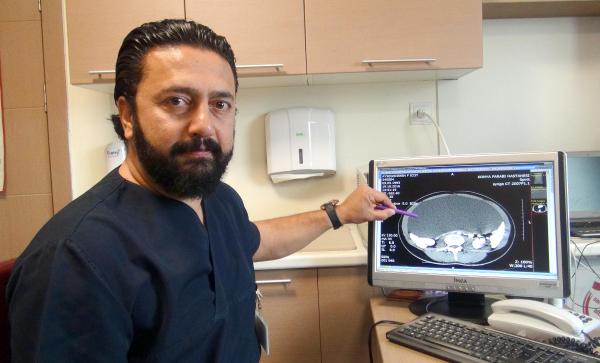 Doktora gitti, karnından 6,5 kilo ur çıktı