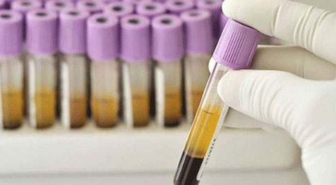 Kanda UIBC Nedir? | UIBC düşüklüğü | UIBC yüksekliği | UIBC'de normal değerler | UIBC düşüklüğü/yüksekliği nasıl normale döner?