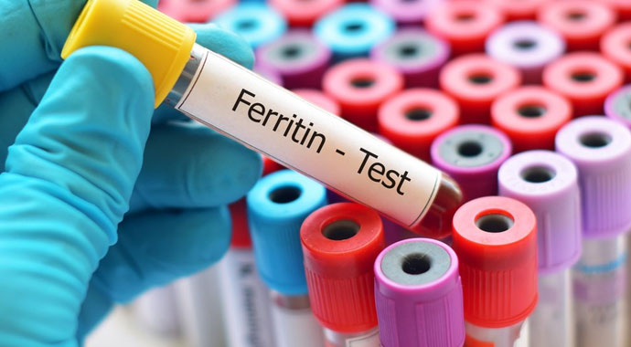 Kanda UIBC Nedir? | UIBC düşüklüğü | UIBC yüksekliği | UIBC'de normal değerler | UIBC düşüklüğü/yüksekliği nasıl normale döner?