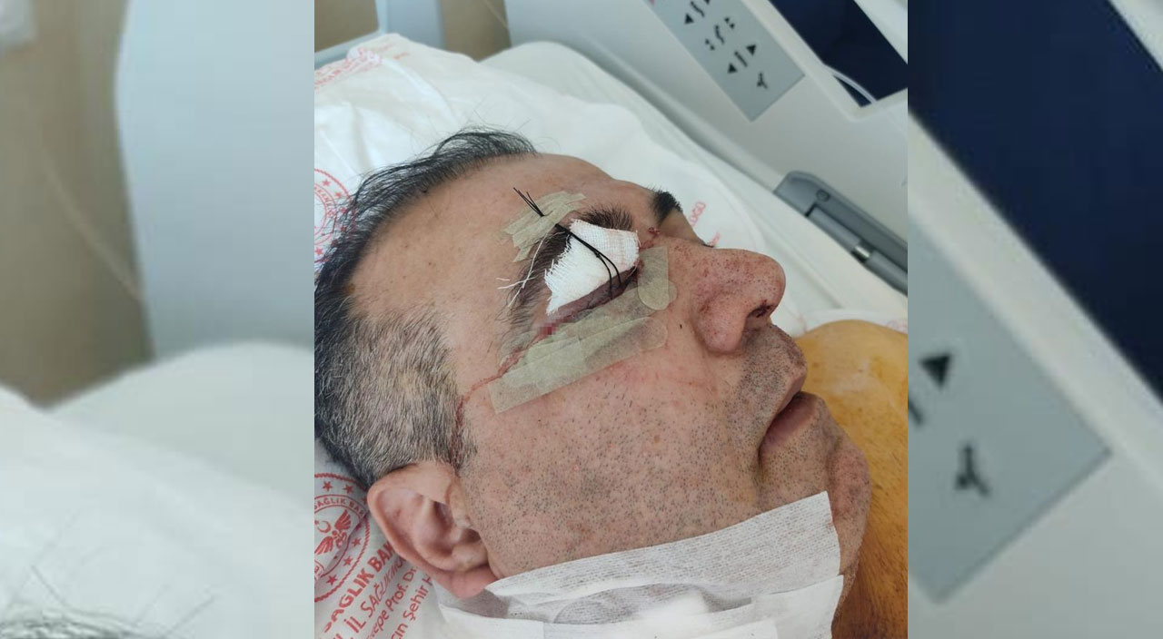 Takside “indi bindi” dehşeti! Taksi ücretine sinirlenen yolcu şoförü vurdu