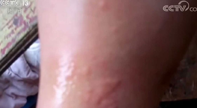 Wuhan'da yarasaların uzmanları ısırdığı anlar ortaya çıktı