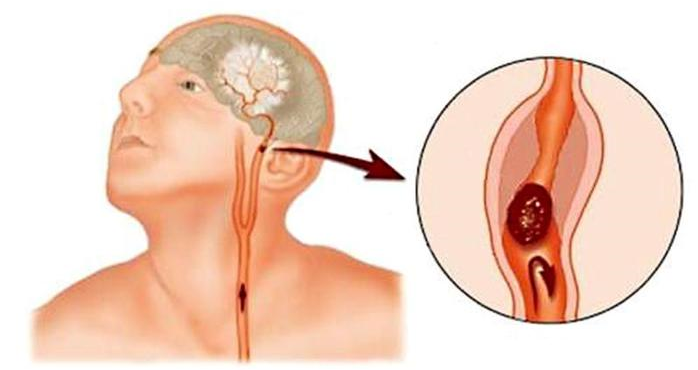 Yüzünüz böyle görünüyorsa hemen doktora koşun! Yüzünüz böyle görünüyorsa hemen doktora koşun!