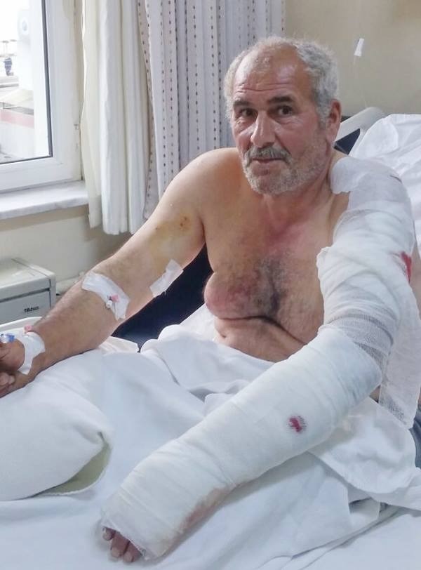 Ayı saldırısına uğrayan vatandaş yaralı kurtuldu