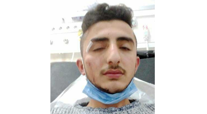 İstanbul’da feci kaza: Ölümden kıl payı kurtuldular