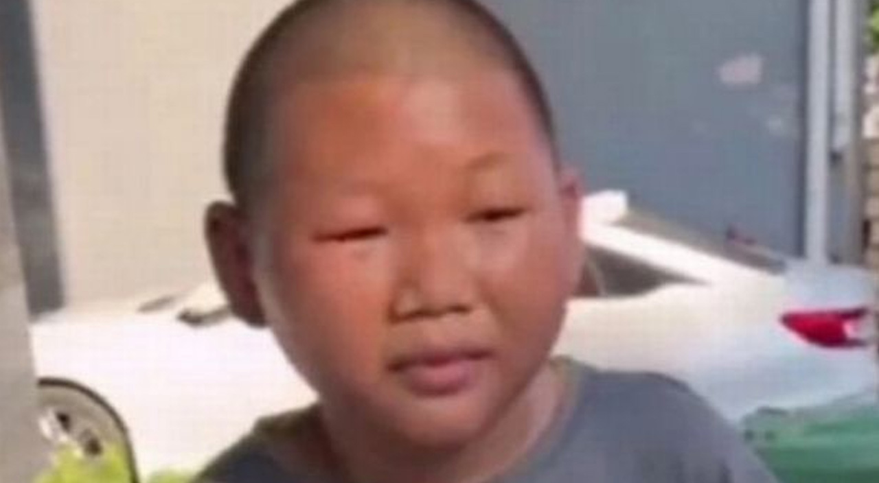 Aslında 27 yaşında! Çocuk gibi görünüyor, kimse iş vermiyor