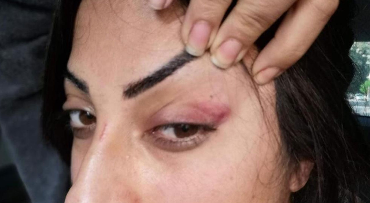 Acısı bitmiyor: Öz annesi tarafından satıldı, kocasından işkence gördü