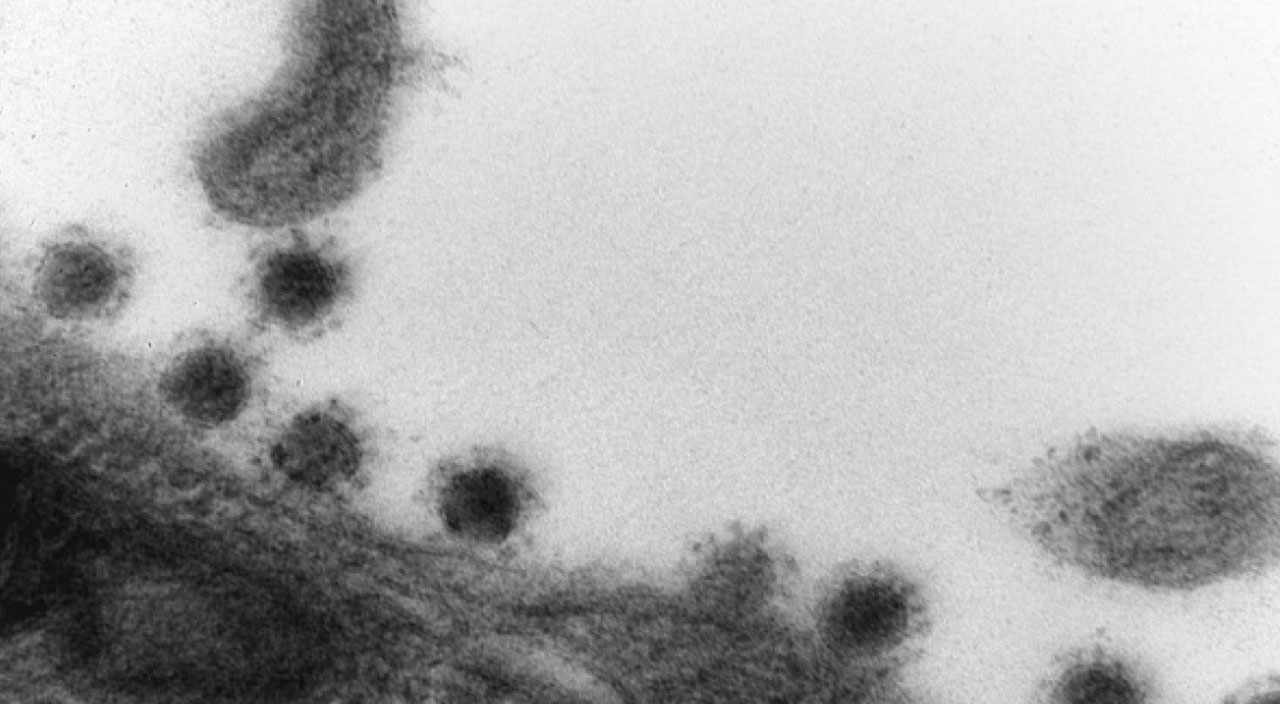 Rusya'da koronavirüs Delta Plus mutasyonu mikroskopla görüntülendi