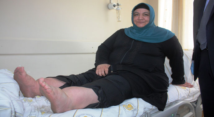 Zayıflamak isterken hayatından oluyordu