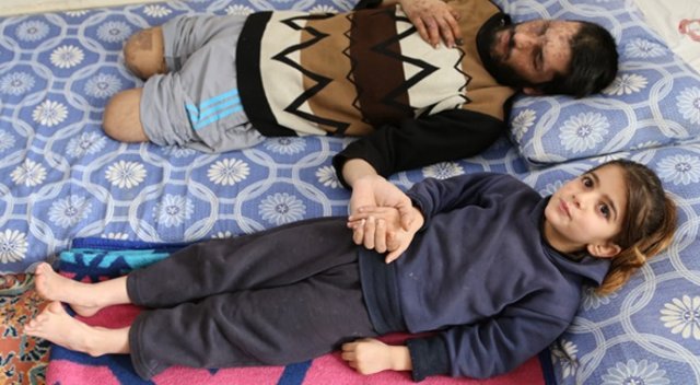 "Gözlerimi alıp babama verin" "Gözlerimi alıp babama verin"