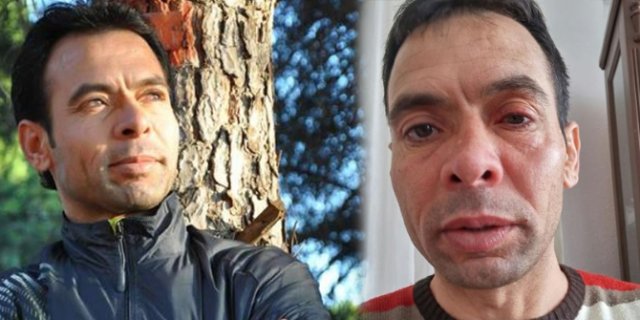 Antrenöre evinde asitli saldırı Antrenöre evinde asitli saldırı