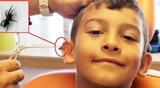 Çocuğun kulağından örümcek çıktı Çocuğun kulağından örümcek çıktı