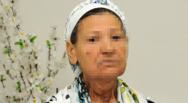 Dilin yerine doku nakledildi: 1 yılda konuştu