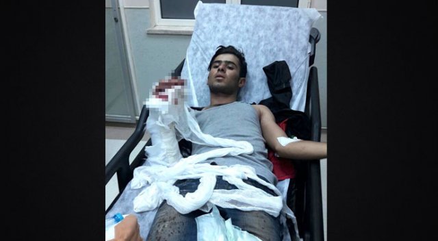 Karakola atmaya çalıştığı EYP elinde patladı Karakola atmaya çalıştığı EYP elinde patladı