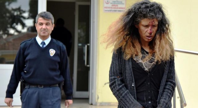 Kadını dövüp burnunu kırdılar