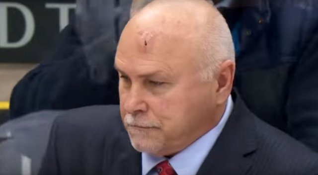 NHL’de görünmez kaza!