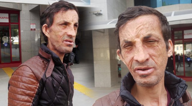 Yüz nakli olan Uğur Acar cinayetle suçlanıyor Yüz nakli olan Uğur Acar cinayetle suçlanıyor