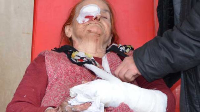 80 yaşında kadını bu hale getirdiler 80 yaşında kadını bu hale getirdiler