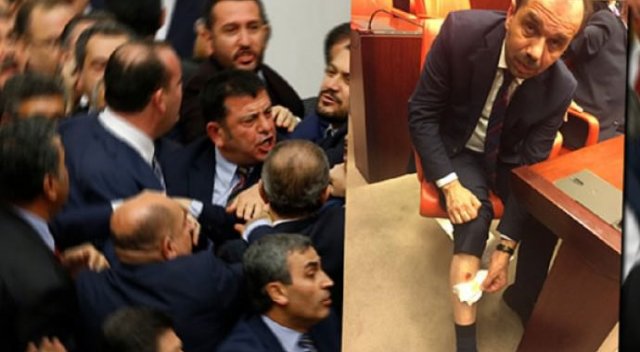Adli Tıp'tan 'ısırık' raporu