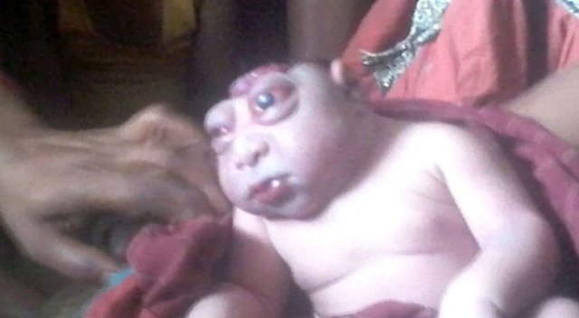 Hindistan'da kafası küçük gözleri büyük doğan bebek ülkeyi kasıp kavuruyor Hindistan'da kafası küçük gözleri büyük doğan bebek ülkeyi kasıp kavuruyor