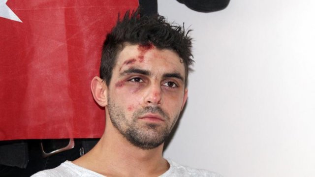 Hollanda polisinin köpekle saldırdığı vatandaşımız konuştu Hollanda polisinin köpekle saldırdığı vatandaşımız konuştu