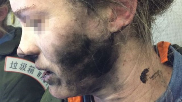 Uçakta kulaklık alev aldı, yolcu hafif yaralandı Uçakta kulaklık alev aldı, yolcu hafif yaralandı