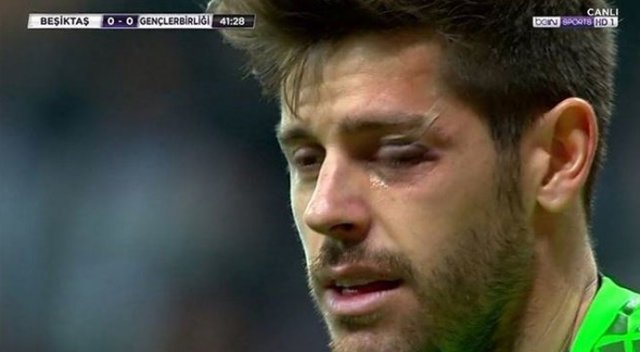 Beşiktaş'ın kalecisi Fabri sakatlandı Beşiktaş'ın kalecisi Fabri sakatlandı