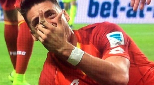 Çok feci! Parmağı ortadan ikiye kırıldı Çok feci! Parmağı ortadan ikiye kırıldı
