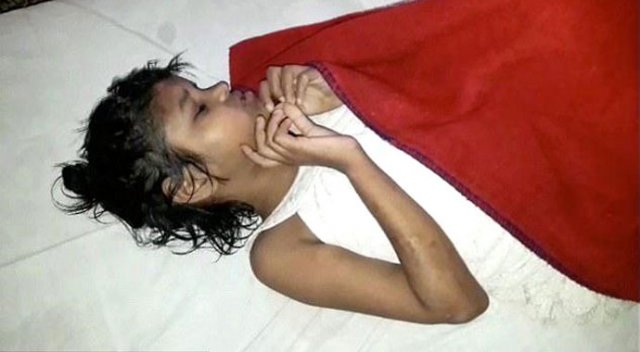 Hindistan'da, maymunlarla yaşayan "yabani" bir kız çocuğu bulundu