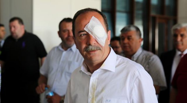 Selfie çektirirken yumurtayı CHP'li başkanın gözüne vurdu Selfie çektirirken yumurtayı CHP'li başkanın gözüne vurdu
