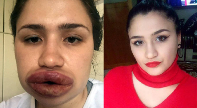 "Sahte estetikçi" kuaföre 2 yeni dava "Sahte estetikçi" kuaföre 2 yeni dava